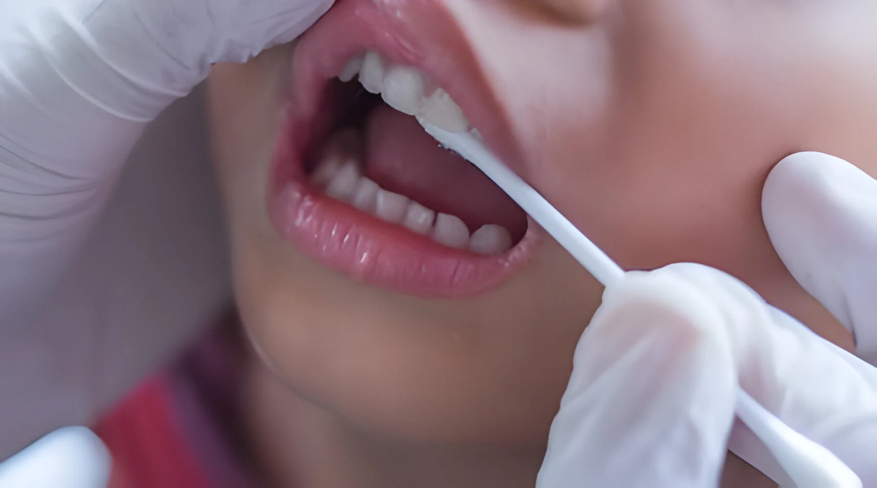 Preventive Dental Care