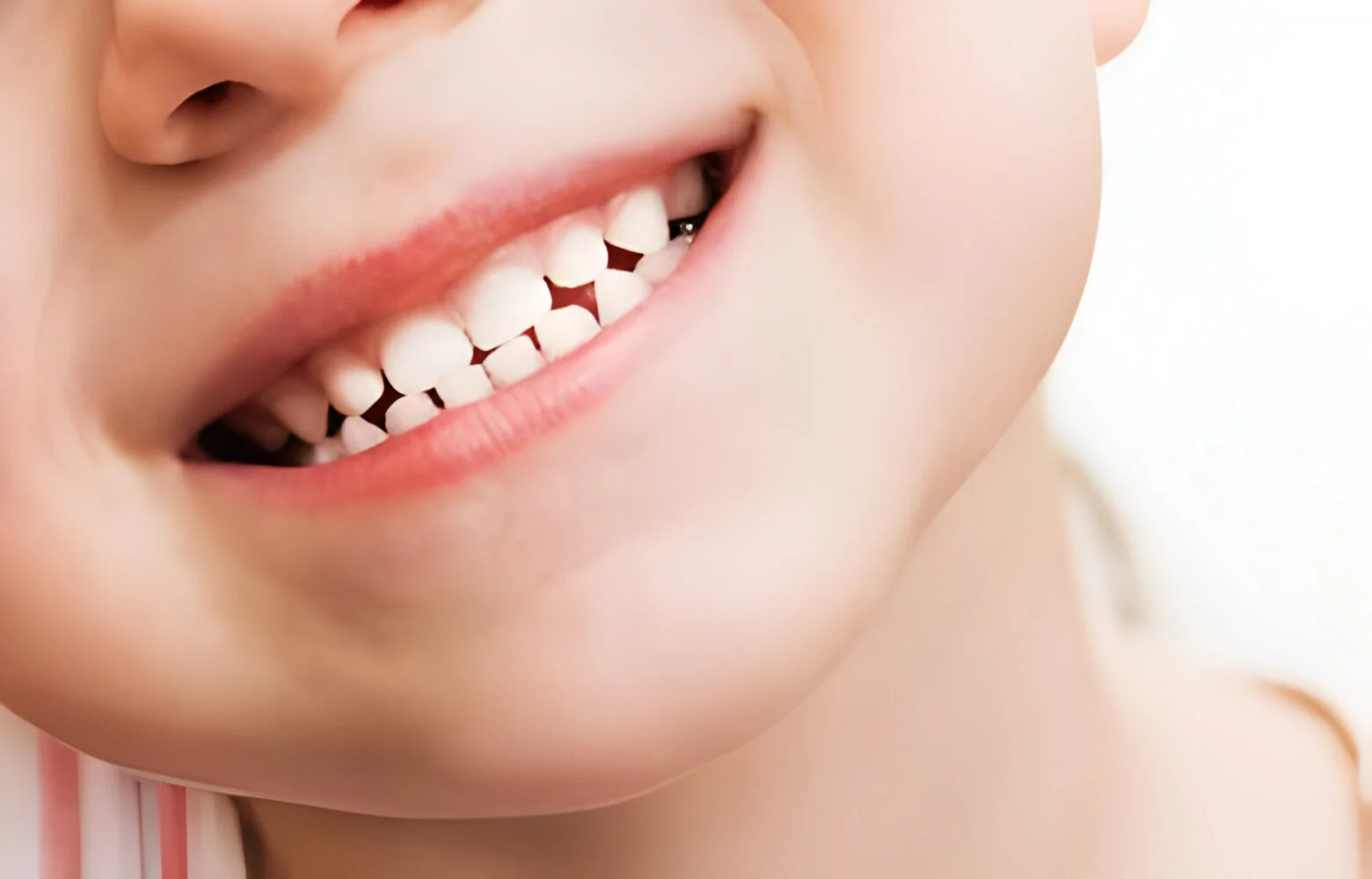Dental Esthetics